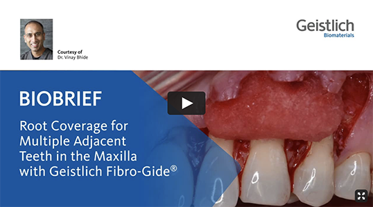 Root Coverage for Multiple Adjacent Teeth in the Maxilla with Geistlich Fibro-Gide<sup>®</sup>